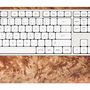 Other smart objects - Computer keyboard - Walnut burl - GEBR. HENTSCHEL GBR